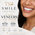 Composite Veneers — 20-Unit Smile Makeover (10 Top & 10 Bottom) | Reservation Deposit