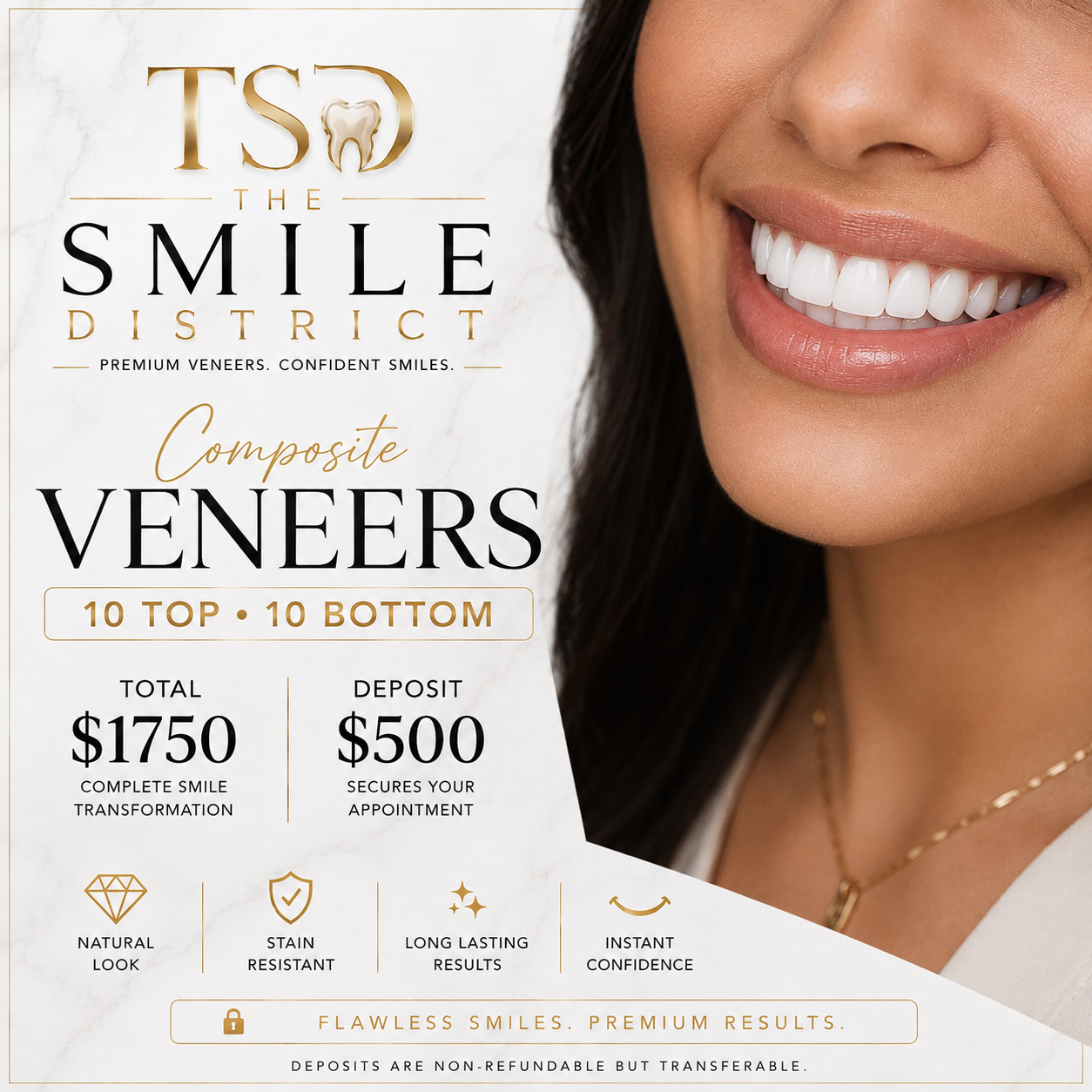 Composite Veneers (DEPOSIT)