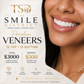 Porcelain Veneers — 20-Unit Luxury Smile Makeover (10 Top & 10 Bottom) | Reservation Deposit